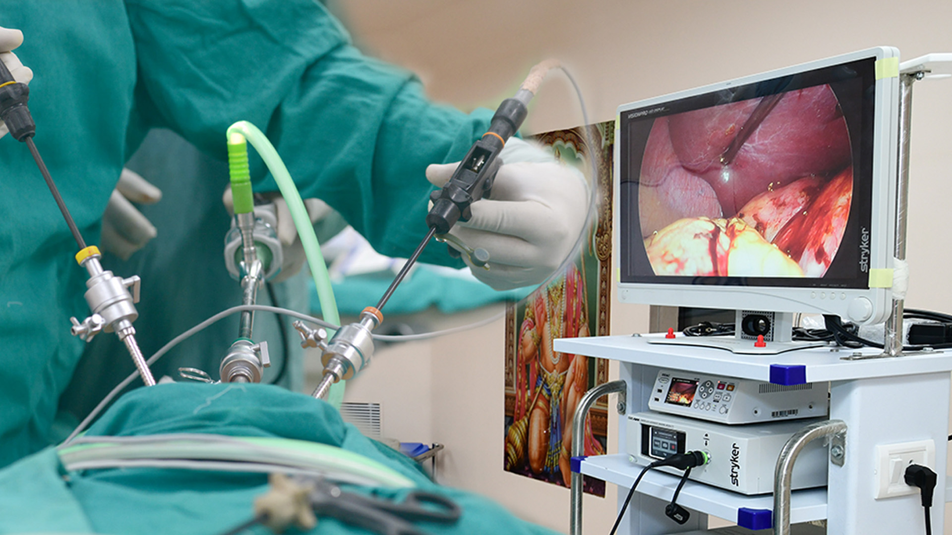 02 Advance Laparoscopic Surgery