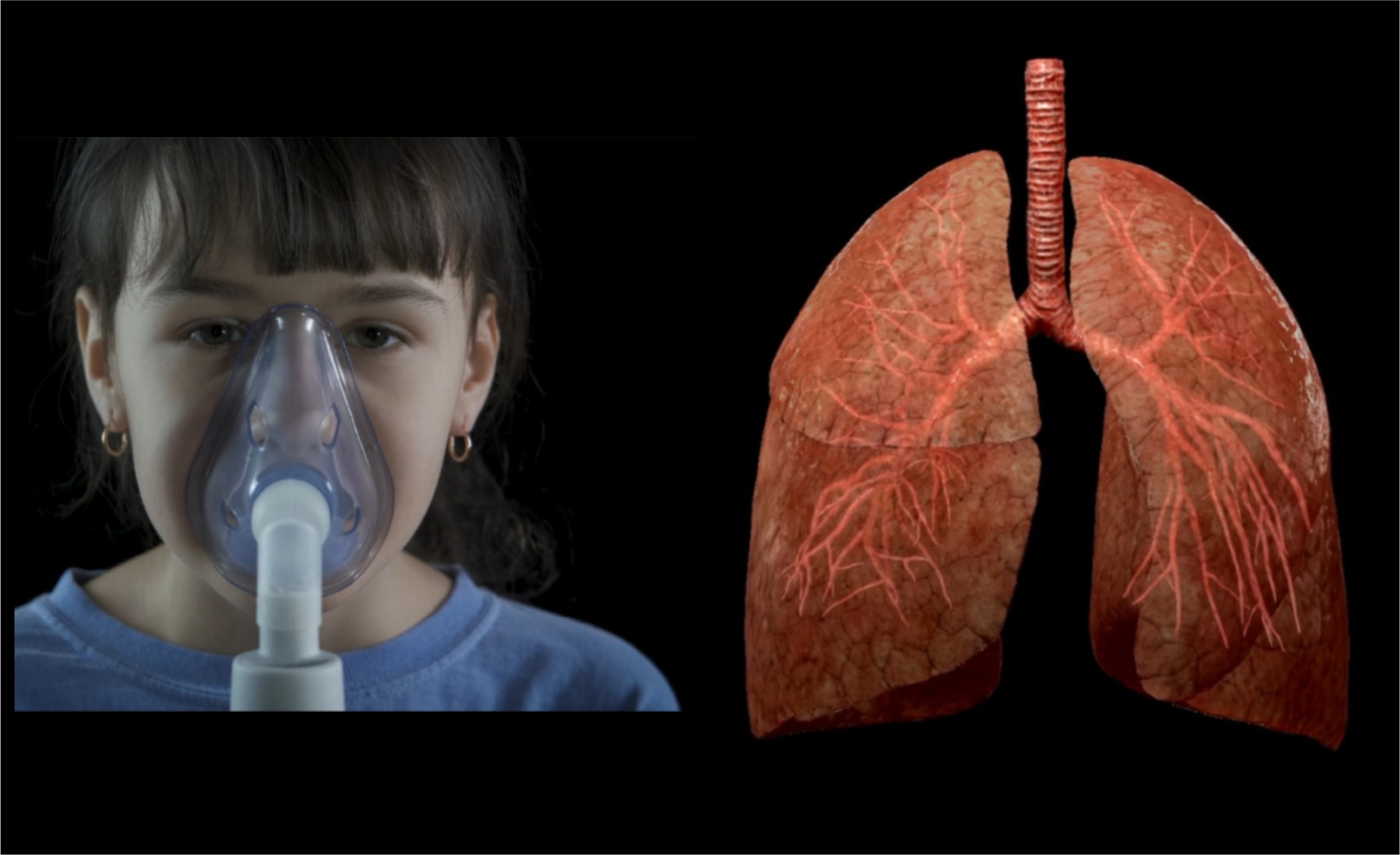 Pulmonary & respiratory medicine