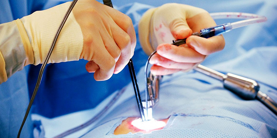Laser Proctology