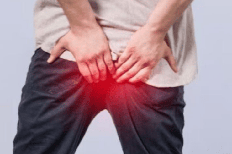 Laser Surgery (Piles, Fissure, Fistula, Renal Stone, Varicose Vein)